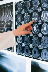 Brain Scan